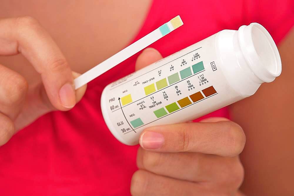 Urine test result