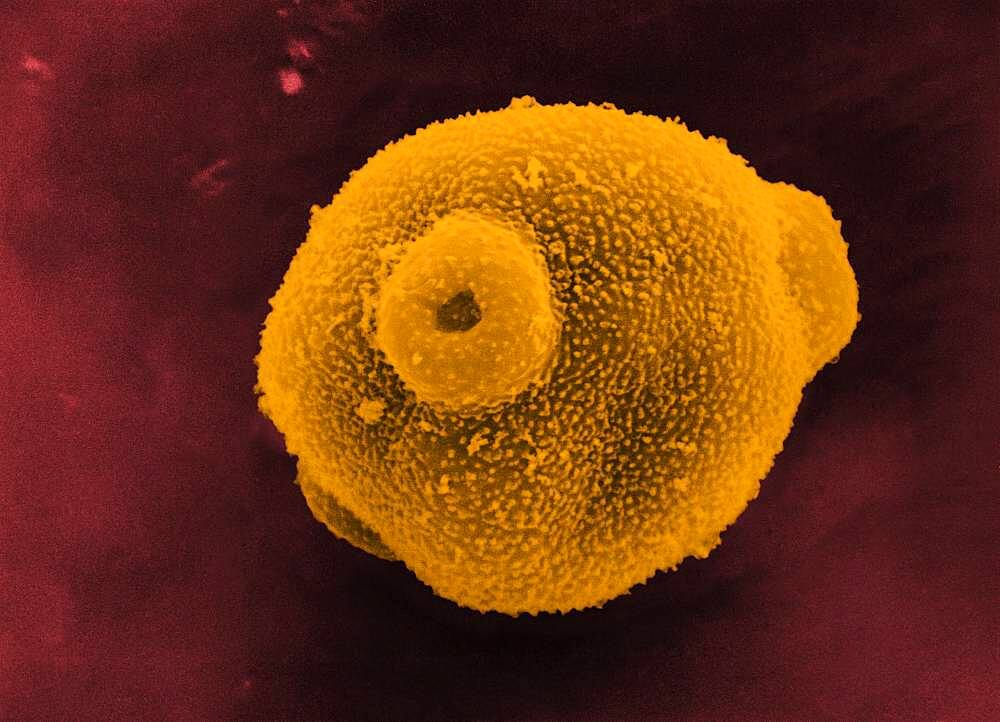 Birch pollen, sem