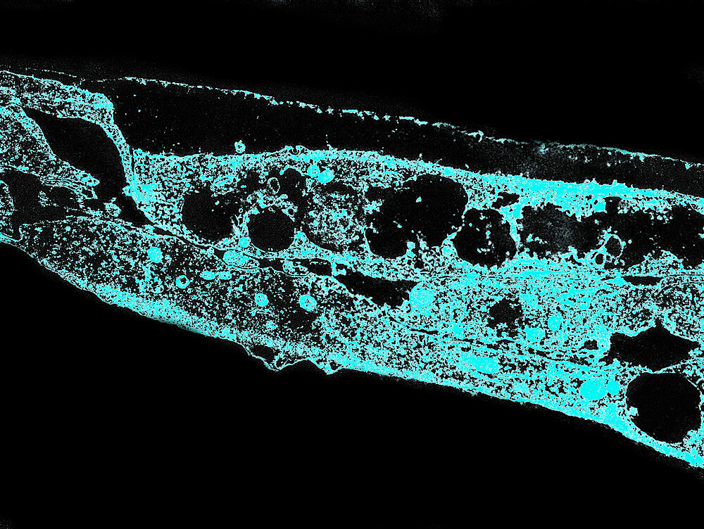 Syphilis bacterium. Treponema pallidum subsp pallidum on cultures of cotton tail rabbit epithelium cells Sf1Ep