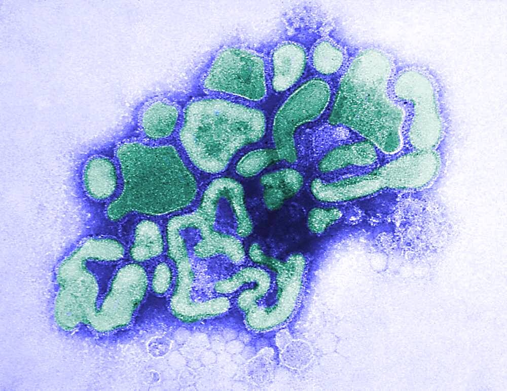 Swine influenza virus