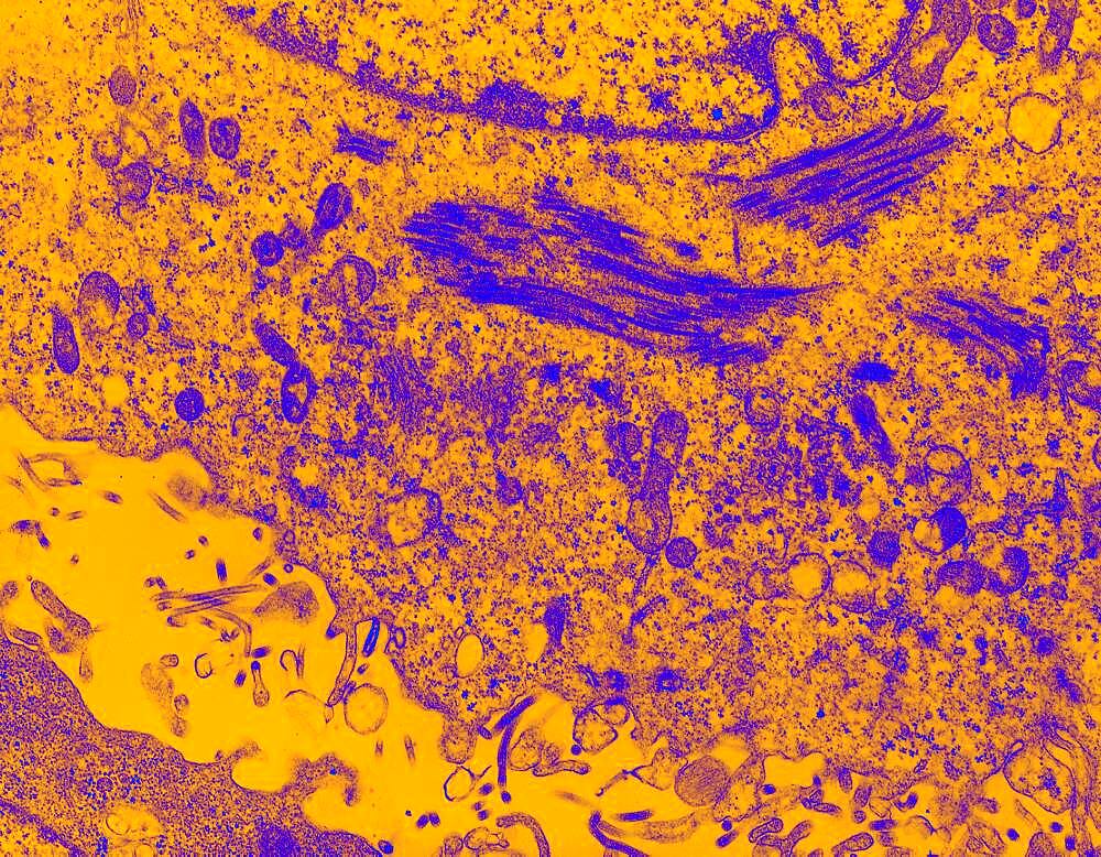 Ebola virus
