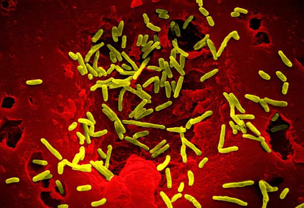 Scanning Electron Micrograph of Mycobacterium chelonae.