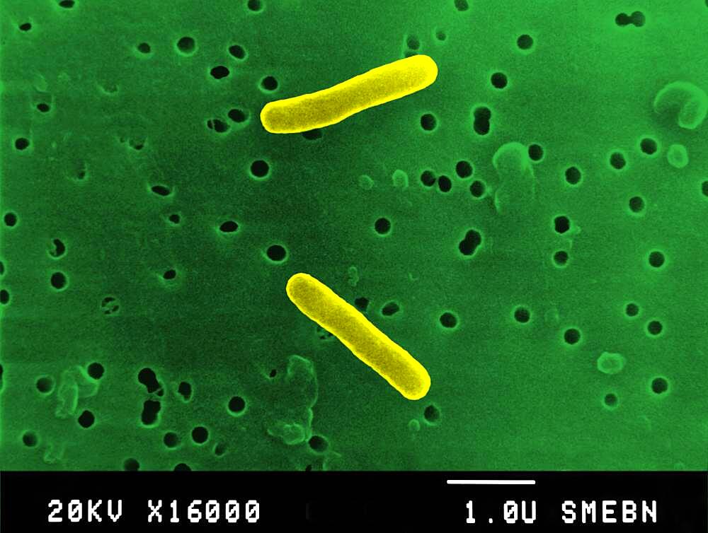 Salmonella typhimurium