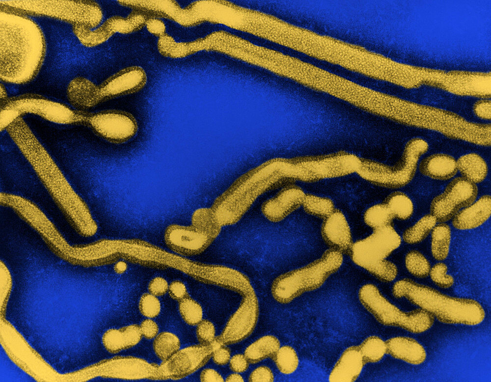 Transmission electron micrograph of influenza A virus, early passage. The swine influenza virus as all Influenza A virus, is a pleomorphic virus