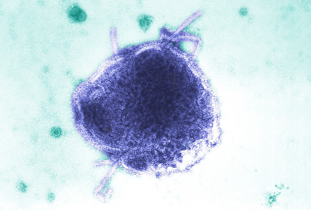 Measles virus (of large size) and SV40 virus (of small size), TEM. This electron micrograph reveals both a paramyxovirus measles virus, and virions of the polyomavirus, simian virus SV40 (smaller circles)