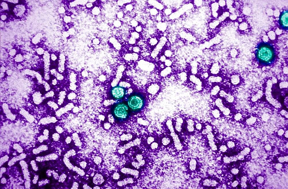 Hepatitis b virus