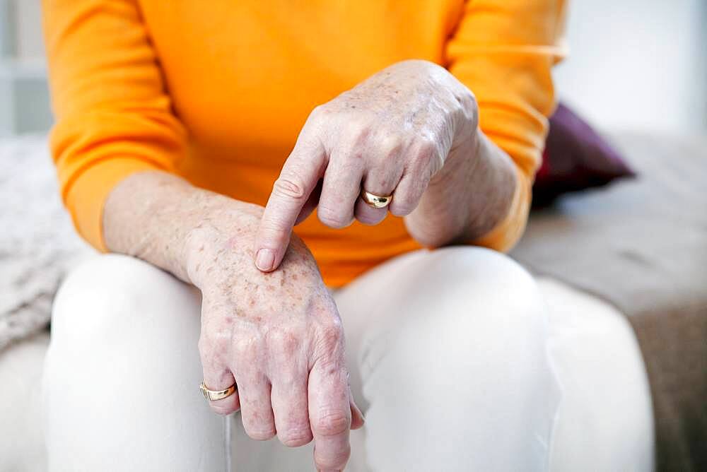 Age spots on senior woman hands.