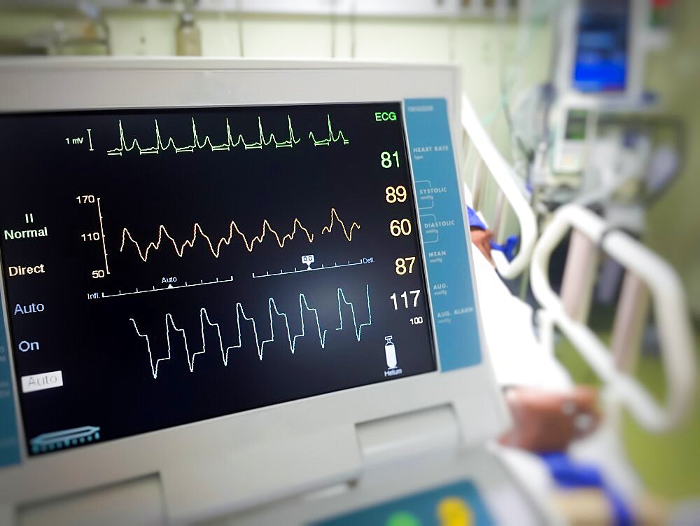 Close up EKG monitor in icu room.