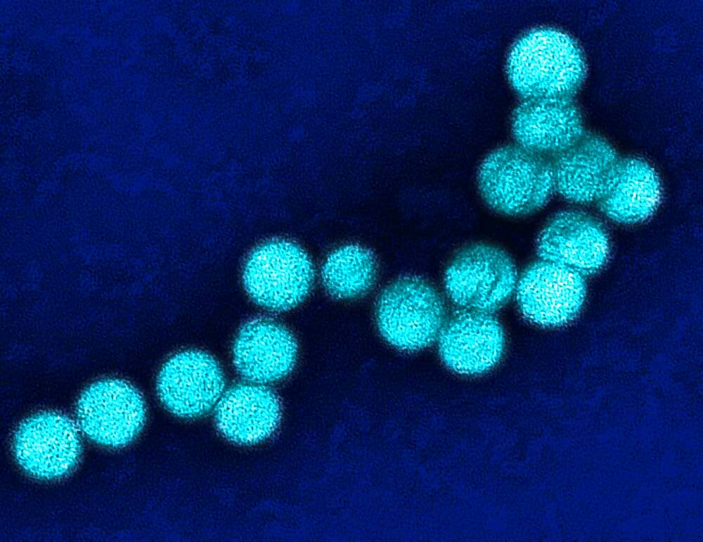 West nile virus