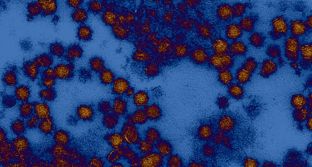 West nile virus