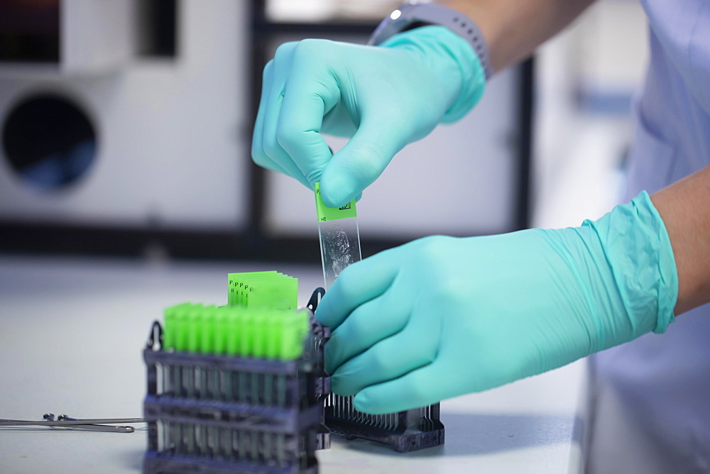 Processing of samples in a histology laboratory, Freiburg, Baden- Wuerttemberg, Germany, Europe