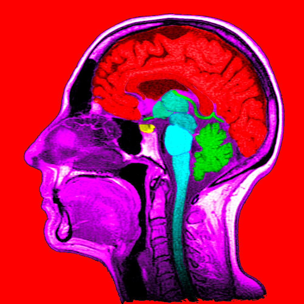 Sagittal section. 1. Brain. 2. Corpus callosum. 3. Septum lucidum. 4. Thalamus. 5. Mamillary body. 6.Mesencephalon. 7. Pons. 8. Medulla oblongata. 9. Spinal cord. 10. Cerbellum. 11. Frontal sinus. 12. Ethmoid cells. 13. Concha. 14. Sphenoida