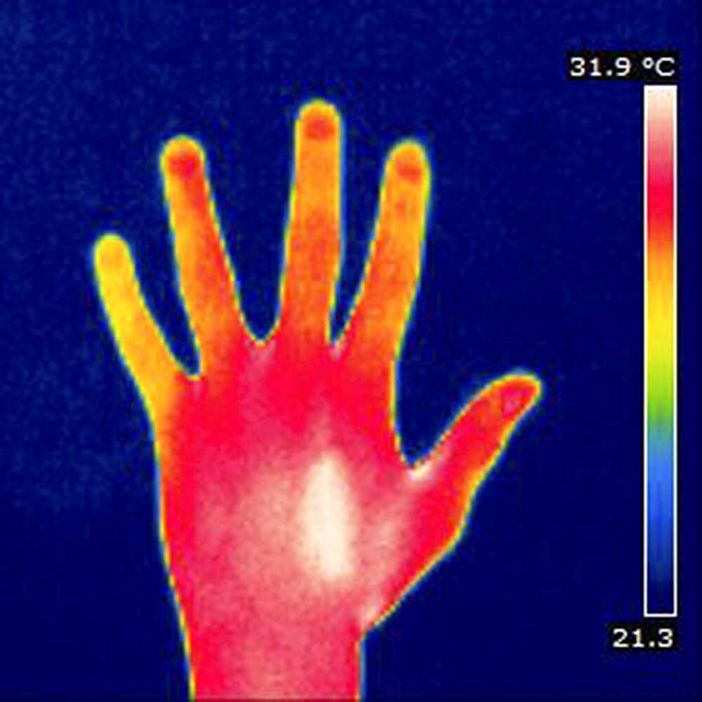 Thermogram