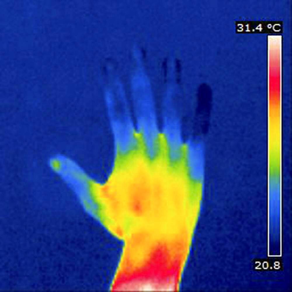 Thermogram