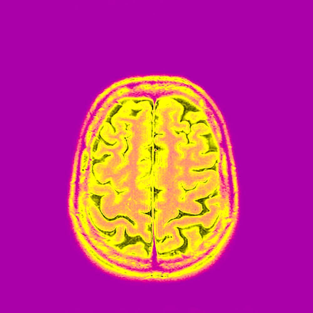 Brain, mri