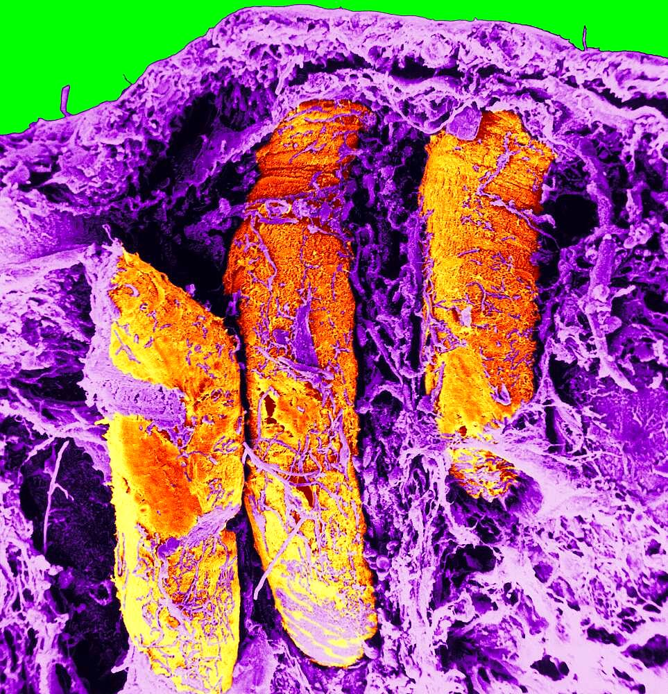 Transversal section of the colon. SEM x 150.