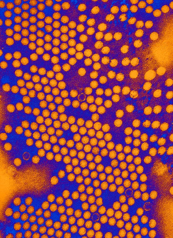 Electron micrograph of the poliovirus. Poliovirus is a species of Enterovirus, which is a genus in the family of Picornaviridae, and is an RNA virus.