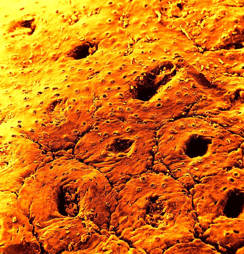 Surface of the colon mucosa. SEM x 200.