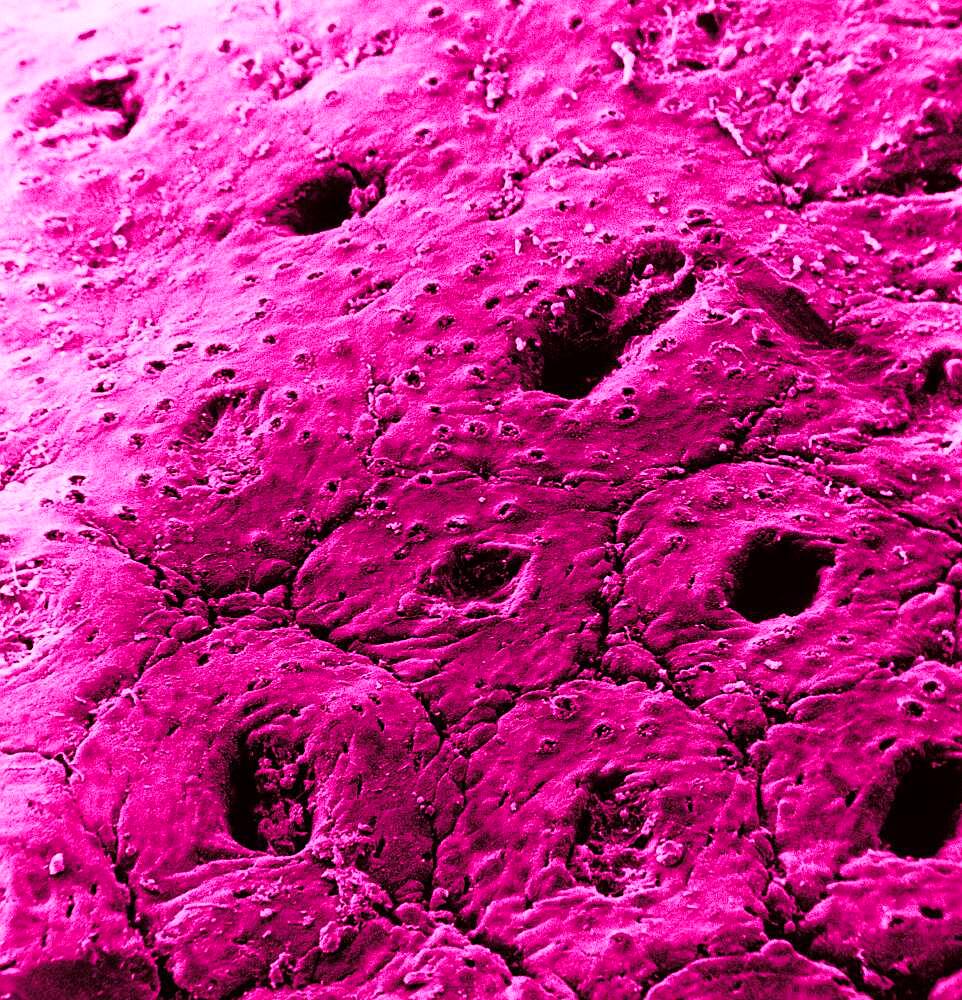 Surface of the colon mucosa. SEM x 200.