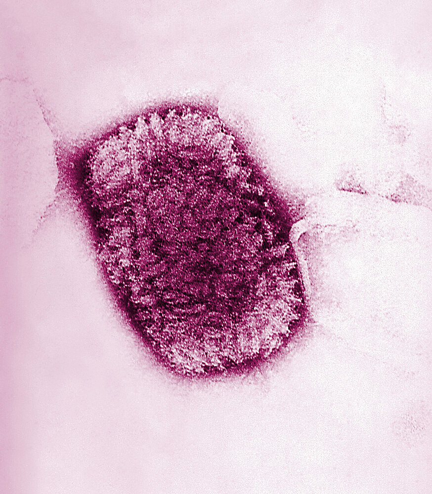 Cowpox virus, used for the preparaton of a smallpox vaccine (TEM). Electron micrograph of a Vaccinia Virus. Vaccinia virus is normally confined to cattle, but is conveyed to humans through vaccination