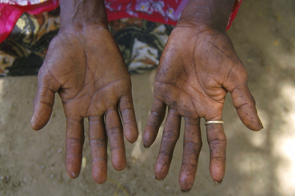 India - women / labour: hands of a tribal woman who picks herbs for a living, tamil nadu