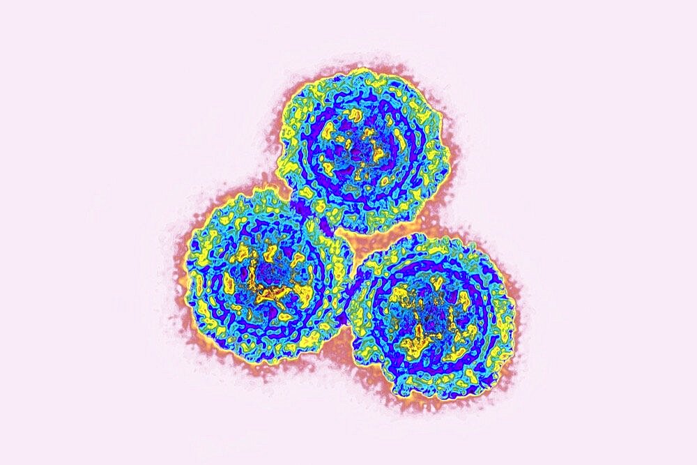 Coronavirus