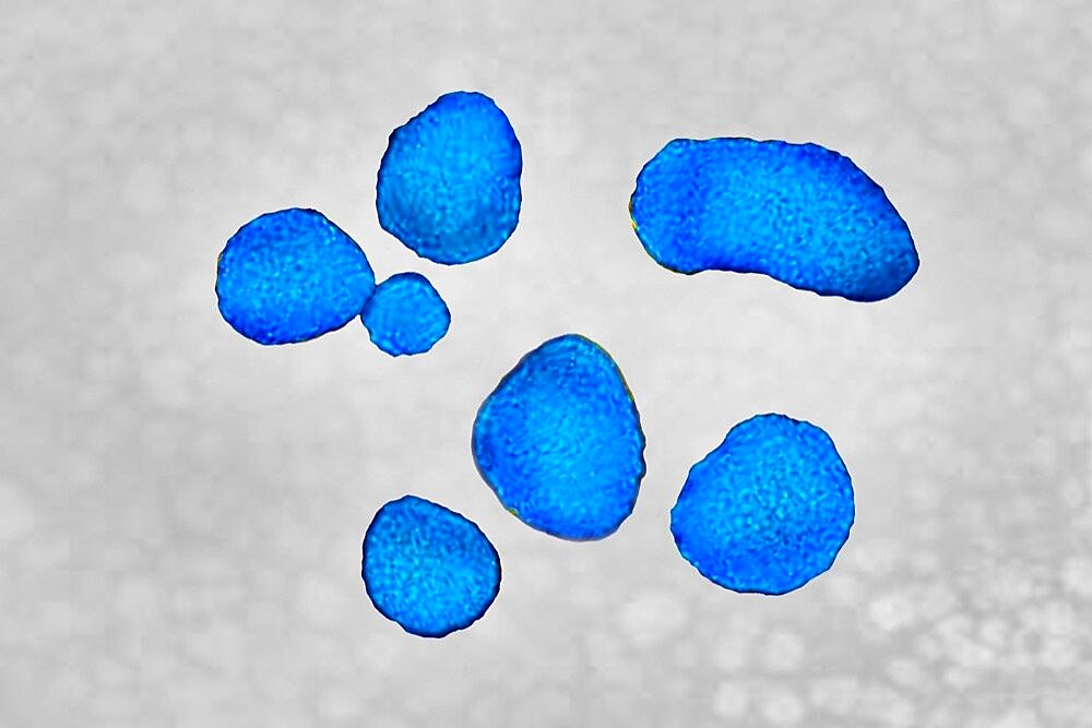 Prevotella bacteria