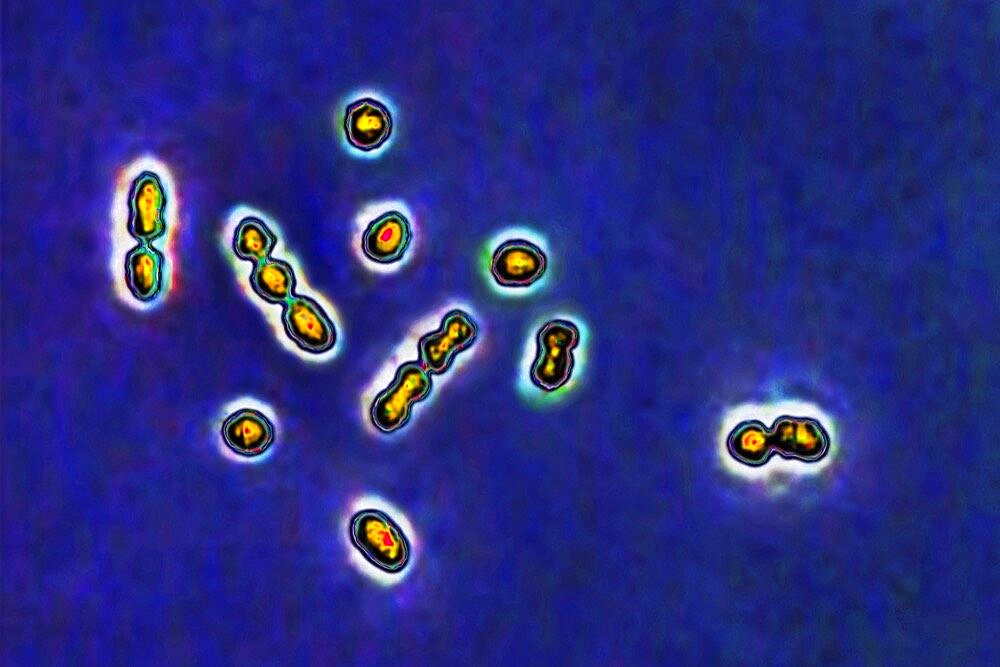 Streptococcus agalactiae