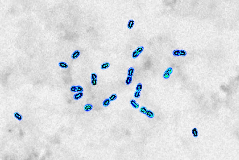 Pneumococcal bacteria