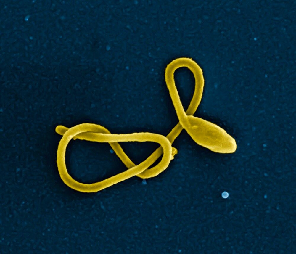 Ebola virus particle