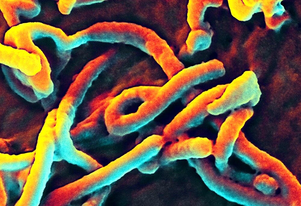 Ebola virus