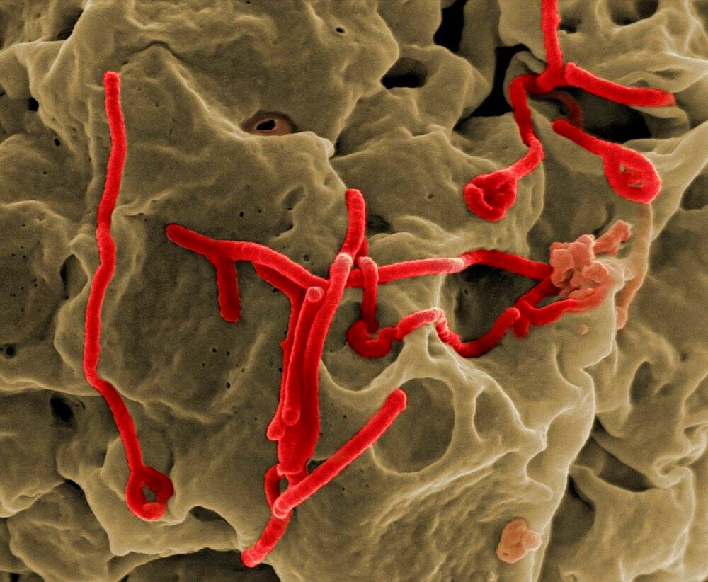 Ebola virus