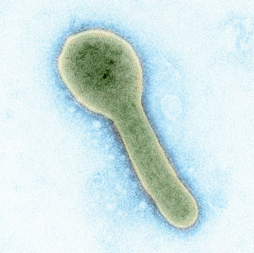 Marburg virus particle