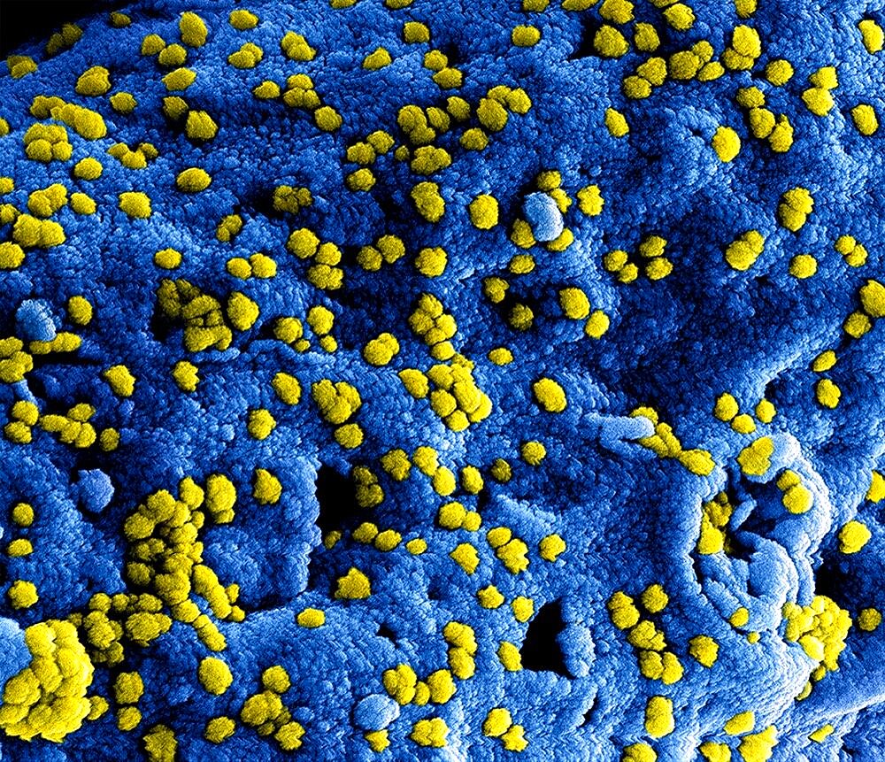 Mers coronavirus particles