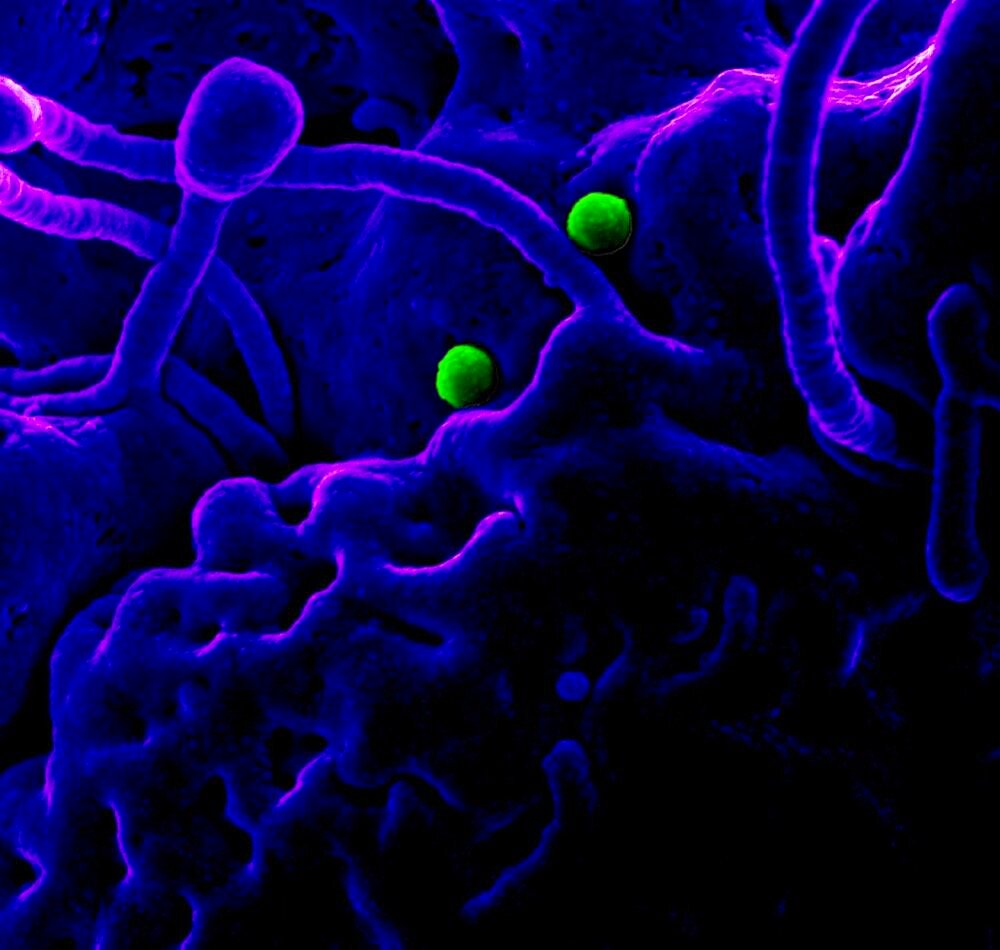 Mers coronavirus particles