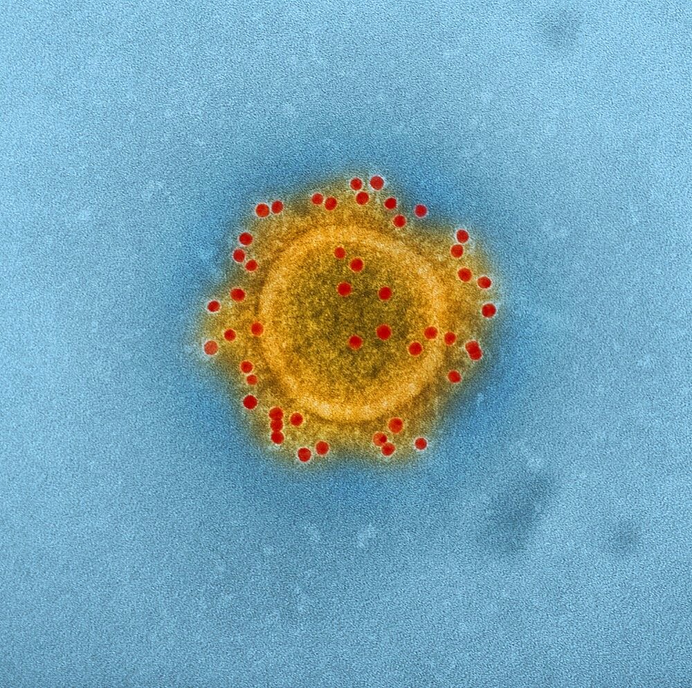 Mers coronavirus particle