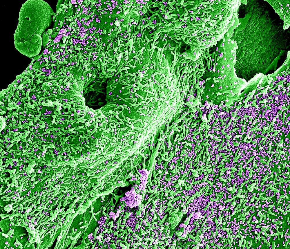 Mers virus particles