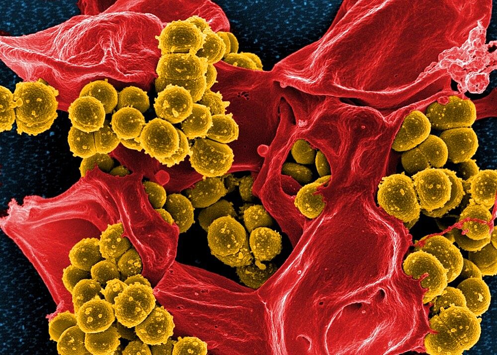 Micrograph of methicillin-resistant staphylococcus aureus (mrsa)