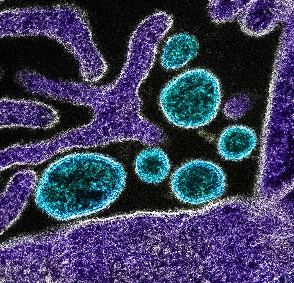 Nipah virus particles