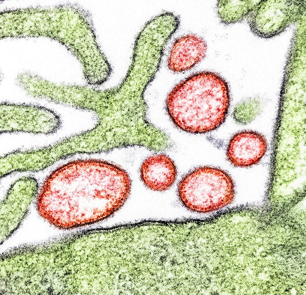 Nipah virus particles