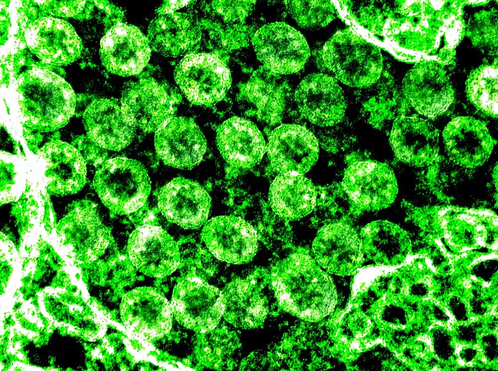 Novel coronavirus sars-cov-2