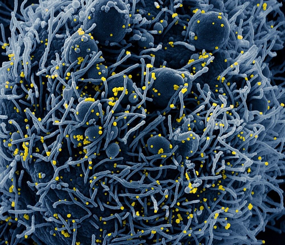 Novel coronavirus sars-cov-2