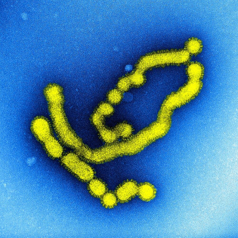 Swine flu strain virus particles