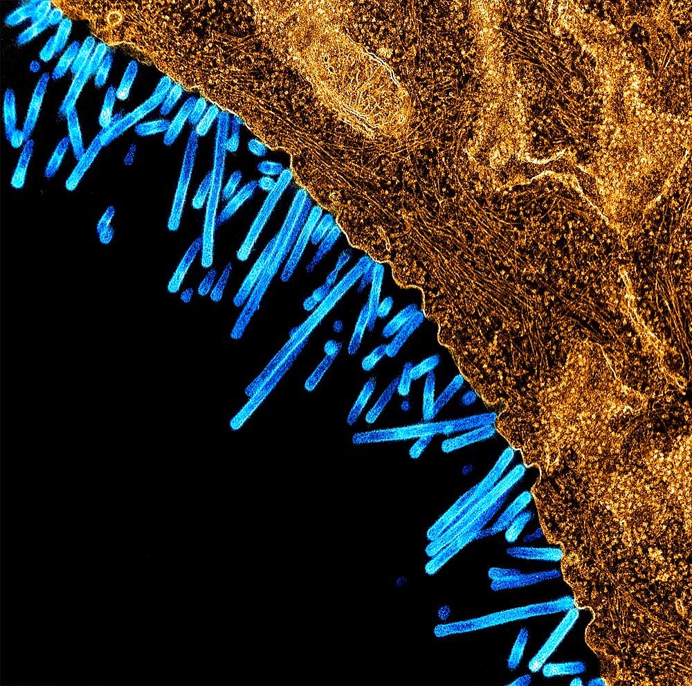 Swine flu virus particles