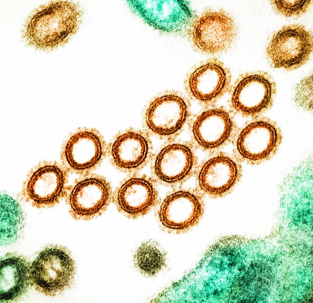 Swine flu virus particles