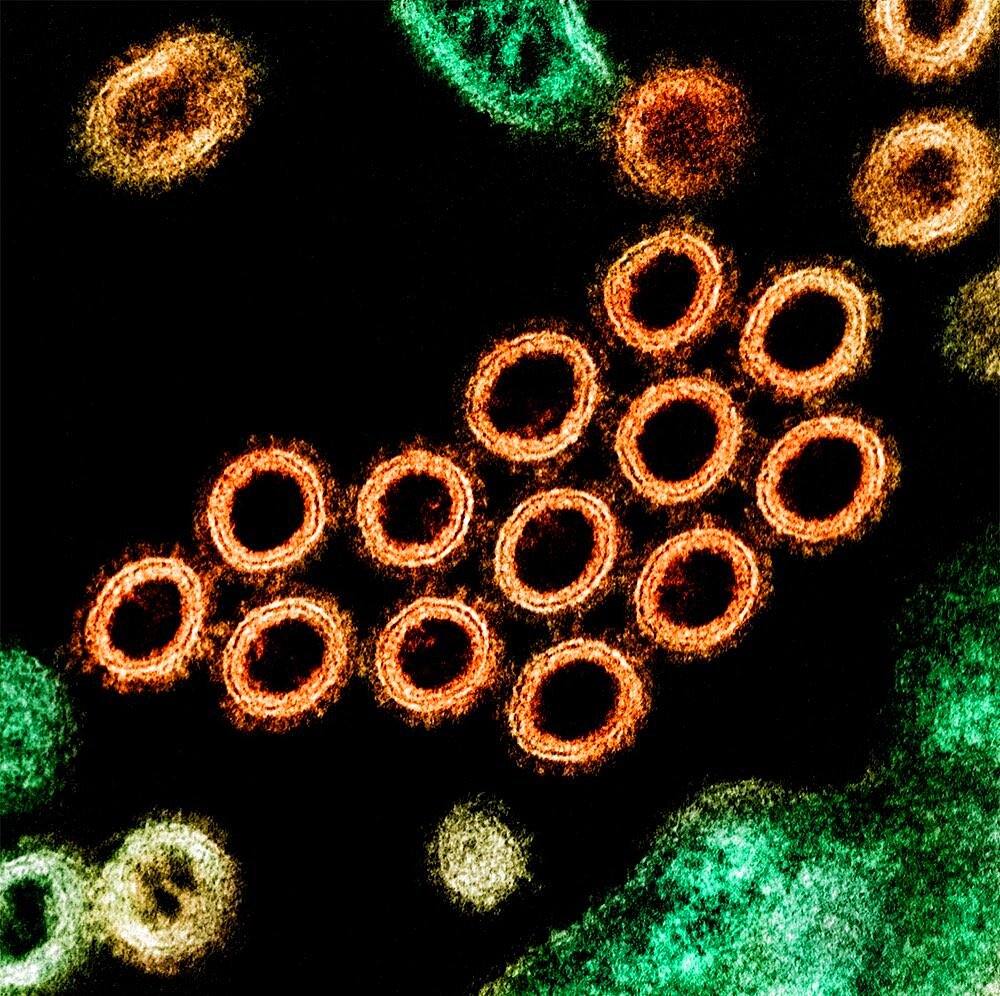 Swine flu virus particles