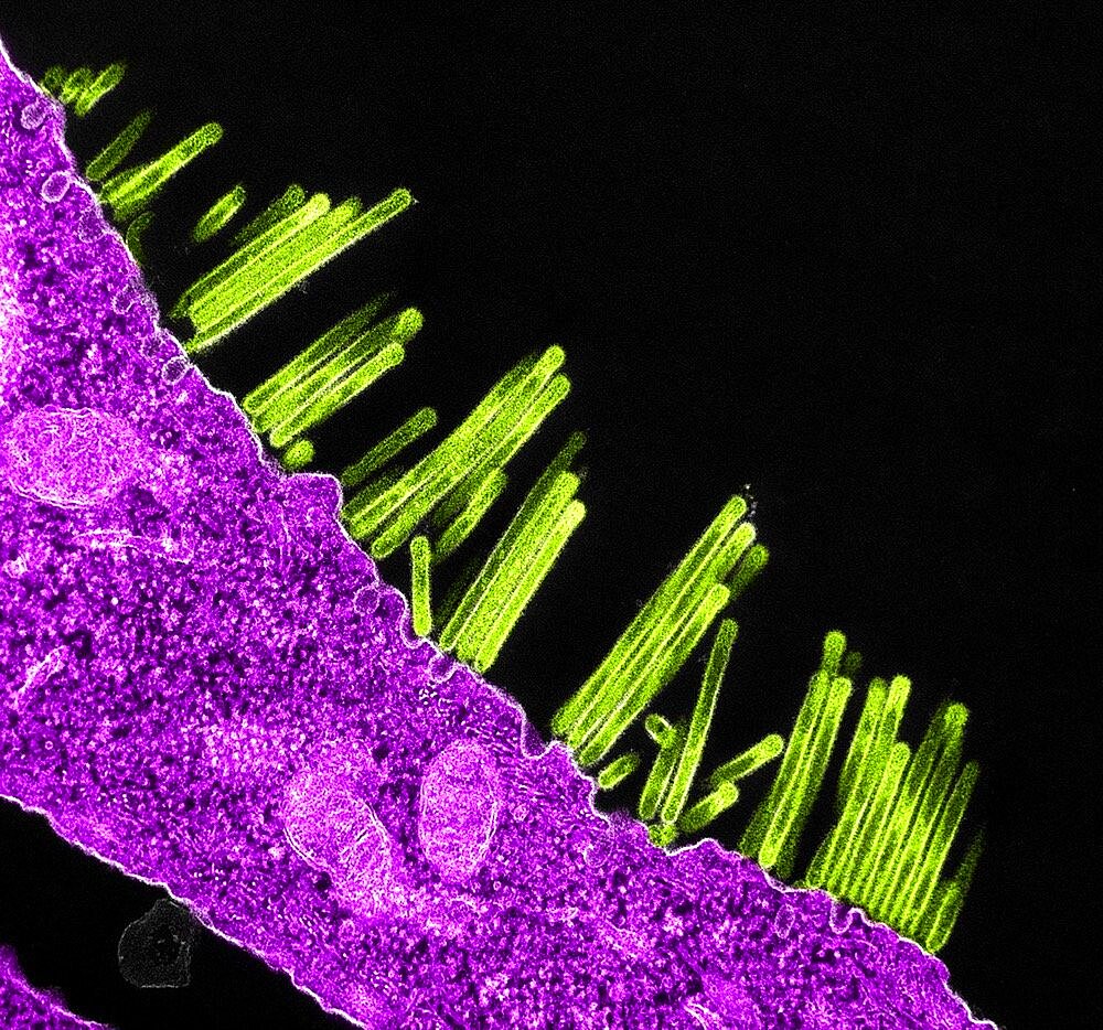 Swine flu virus particles