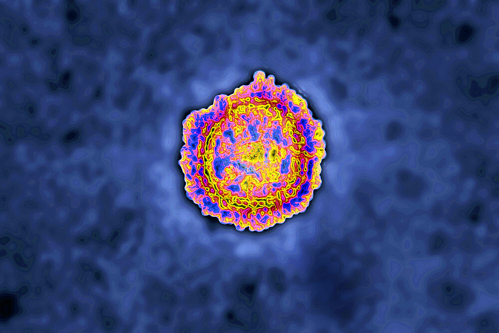 Coronavirus, virus of the family Coronaviridae and of the subfamily Orthocoronavirinae. View from a transmission electron microscopy (TEM) image