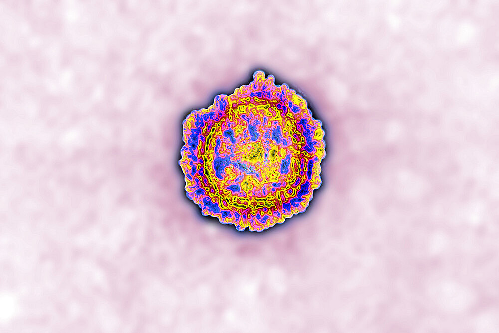 Coronavirus, virus of the family Coronaviridae and of the subfamily Orthocoronavirinae. View from a transmission electron microscopy (TEM) image