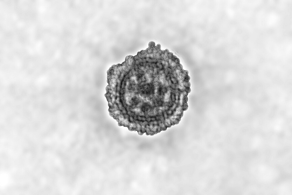 Coronavirus, virus of the family Coronaviridae and of the subfamily Orthocoronavirinae. View from a transmission electron microscopy (TEM) image